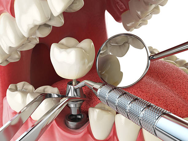 Best Emergency Treatment for Oral Infections in Mckeesport, PA